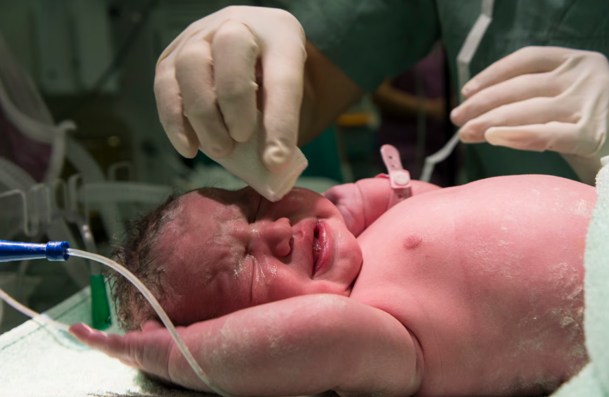 Managing Emergency Interventions During Childbirth